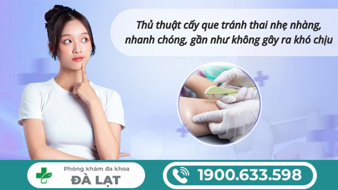 Hình ảnh minh họa